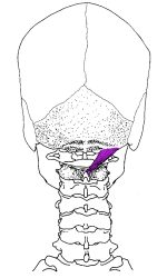 RECTUS CAPITIS POSTERIOR MAJOR